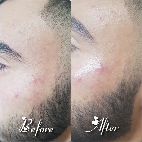 Nadire Güzellik Salonu - 42. Fotoğraf Nadire Güzellik Salonu - 42. Fotoğraf