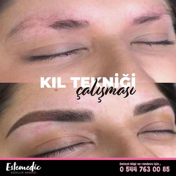 Estemedic Güzellik Merkezi - 6. Fotoğraf