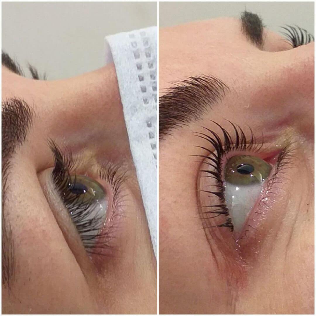 Estemedic Güzellik Merkezi - Kızılay  Kaş Tasarımı Salonları - 2. Fotoğraf