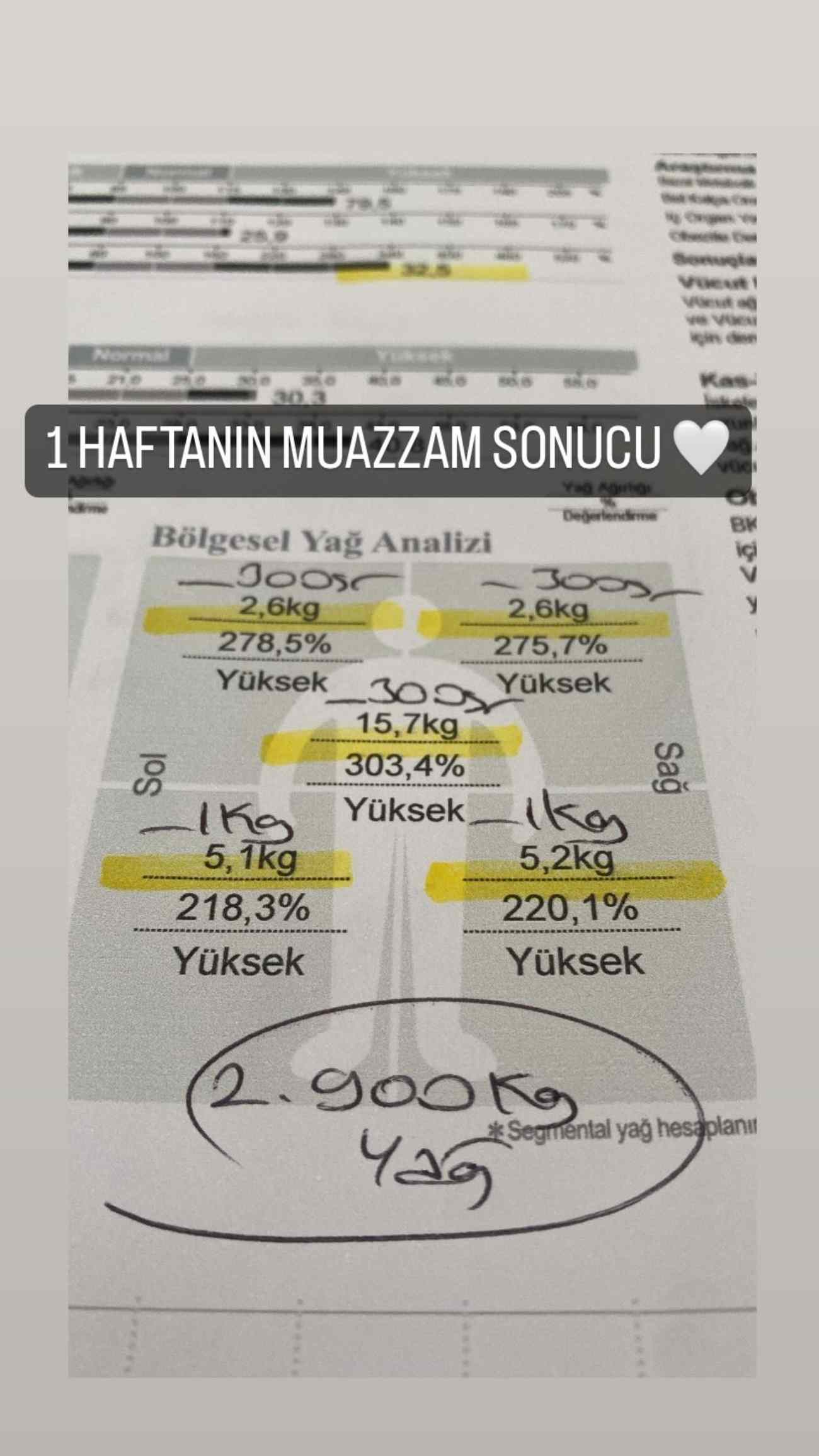 Uzman Diyetisyen Büşra Yılmaz