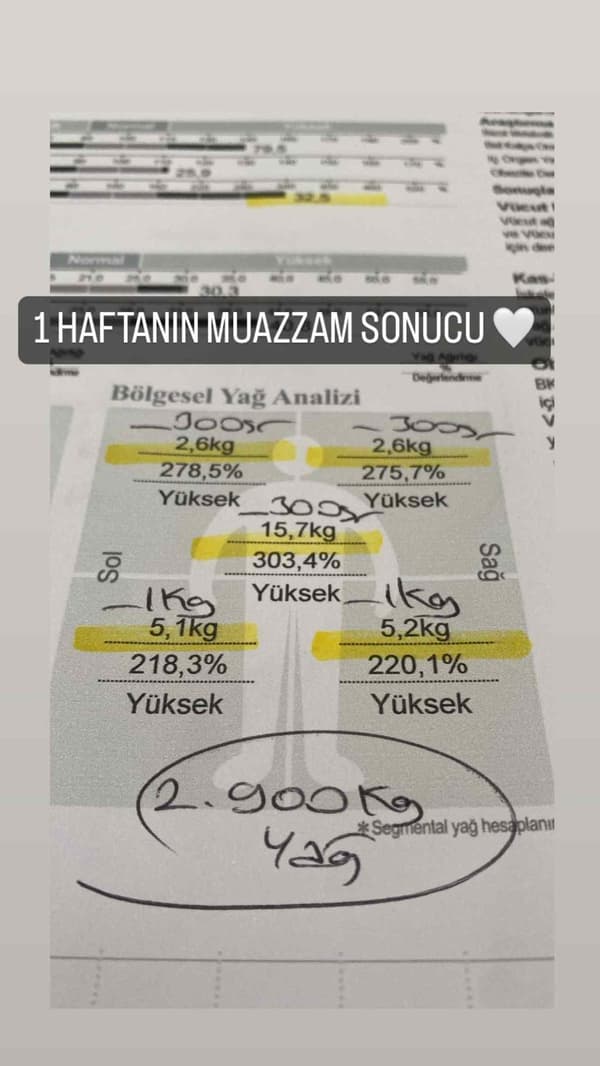 Uzman Diyetisyen Büşra Yılmaz - 28. Fotoğraf