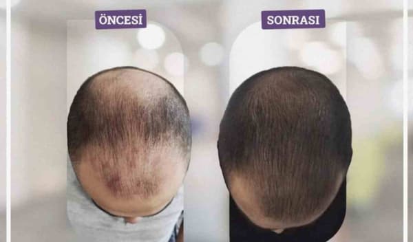 Touch Güzellik Salonu - 21. Fotoğraf