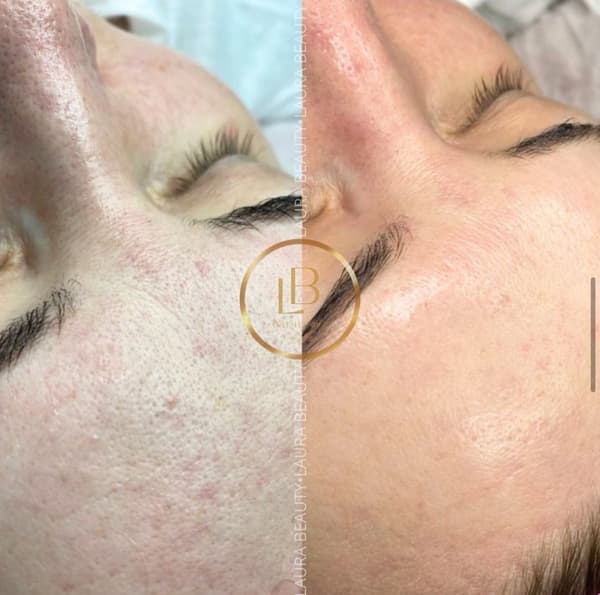 Laura Beauty  - 8. Fotoğraf