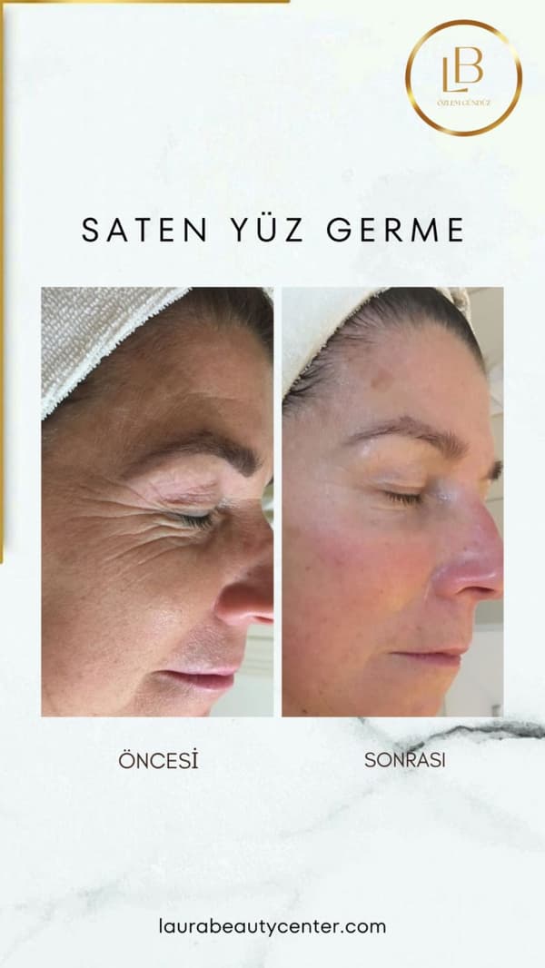 Laura Beauty  - 7. Fotoğraf