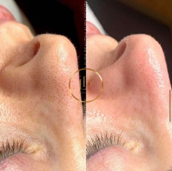 Laura Beauty  - 5. Fotoğraf