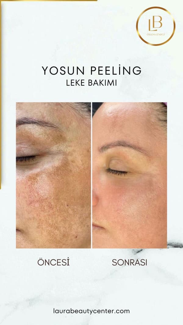 Laura Beauty  - 6. Fotoğraf