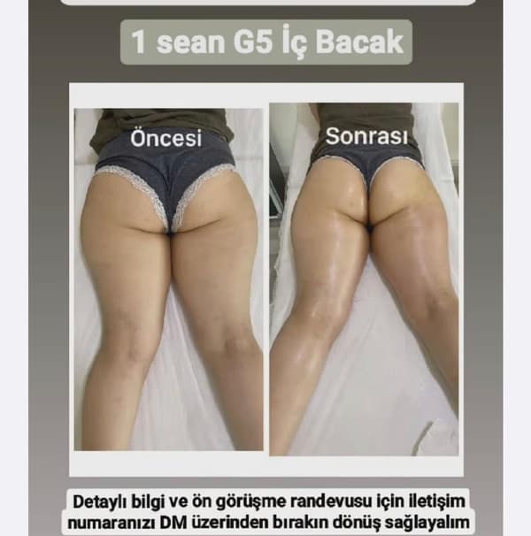 Songül Şahin Güzellik Salonu - 22. Fotoğraf
