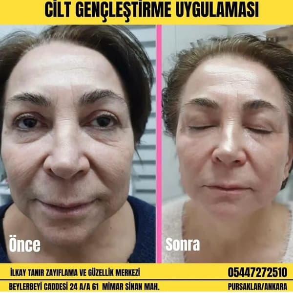 İlkay Tanır Güzellik Salonu - 1. Fotoğraf