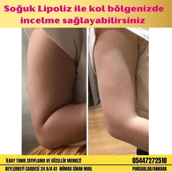 İlkay Tanır Güzellik Salonu - 2. Fotoğraf