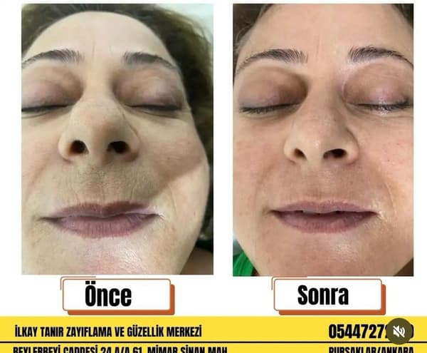 İlkay Tanır Güzellik Salonu - 6. Fotoğraf