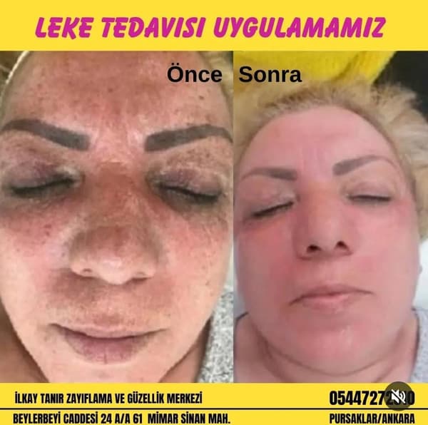 İlkay Tanır Güzellik Salonu - 3. Fotoğraf