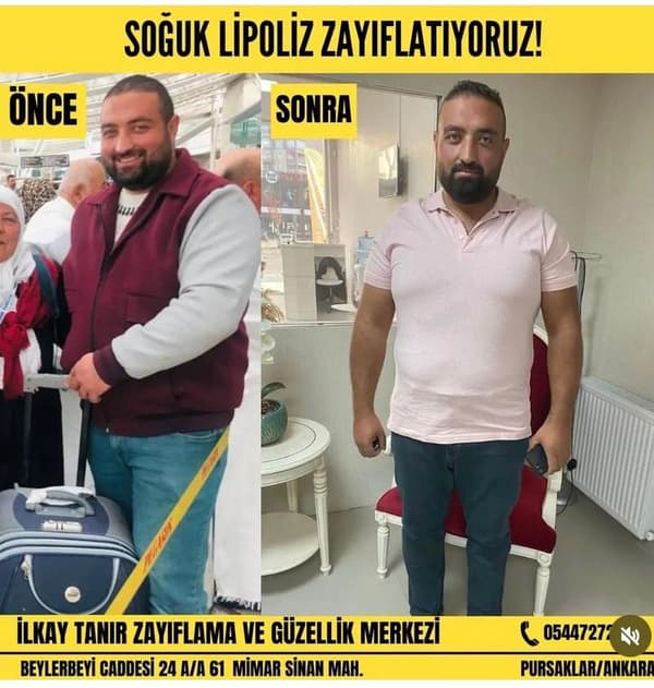 İlkay Tanır Güzellik Salonu - 7. Fotoğraf