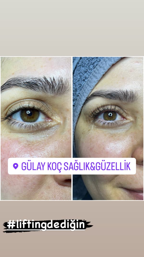 Gülay Koç Güzellik - 5. Fotoğraf