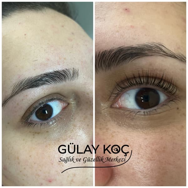 Gülay Koç Güzellik - 6. Fotoğraf