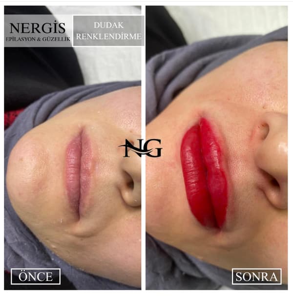 Nergis Epilasyon ve Güzellik - 1. Fotoğraf