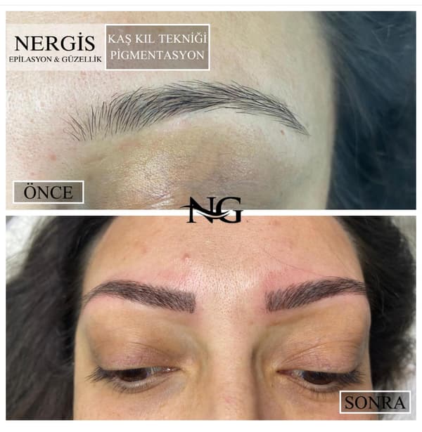 Nergis Epilasyon ve Güzellik - 5. Fotoğraf
