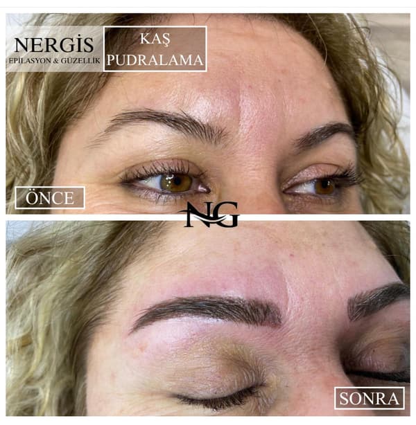 Nergis Epilasyon ve Güzellik - 2. Fotoğraf