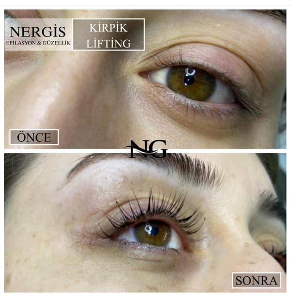 Nergis Epilasyon ve Güzellik - 3. Fotoğraf