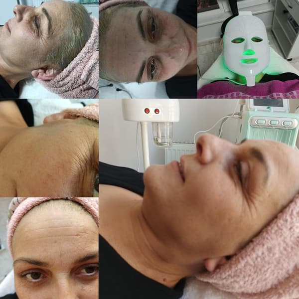 Zeynep Gökgöz Güzellik - 7. Fotoğraf