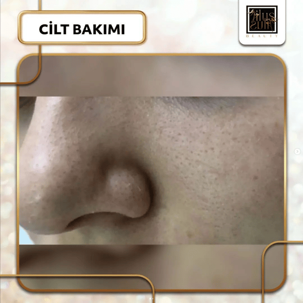 İlus Güzellik Salonu - 14. Fotoğraf