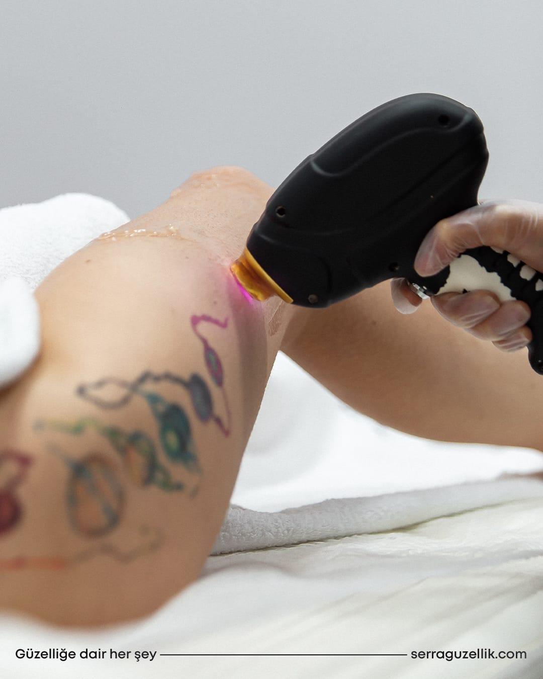 Serra Güzellik - Ümitköy  Cilt Yenileme - 4. Fotoğraf