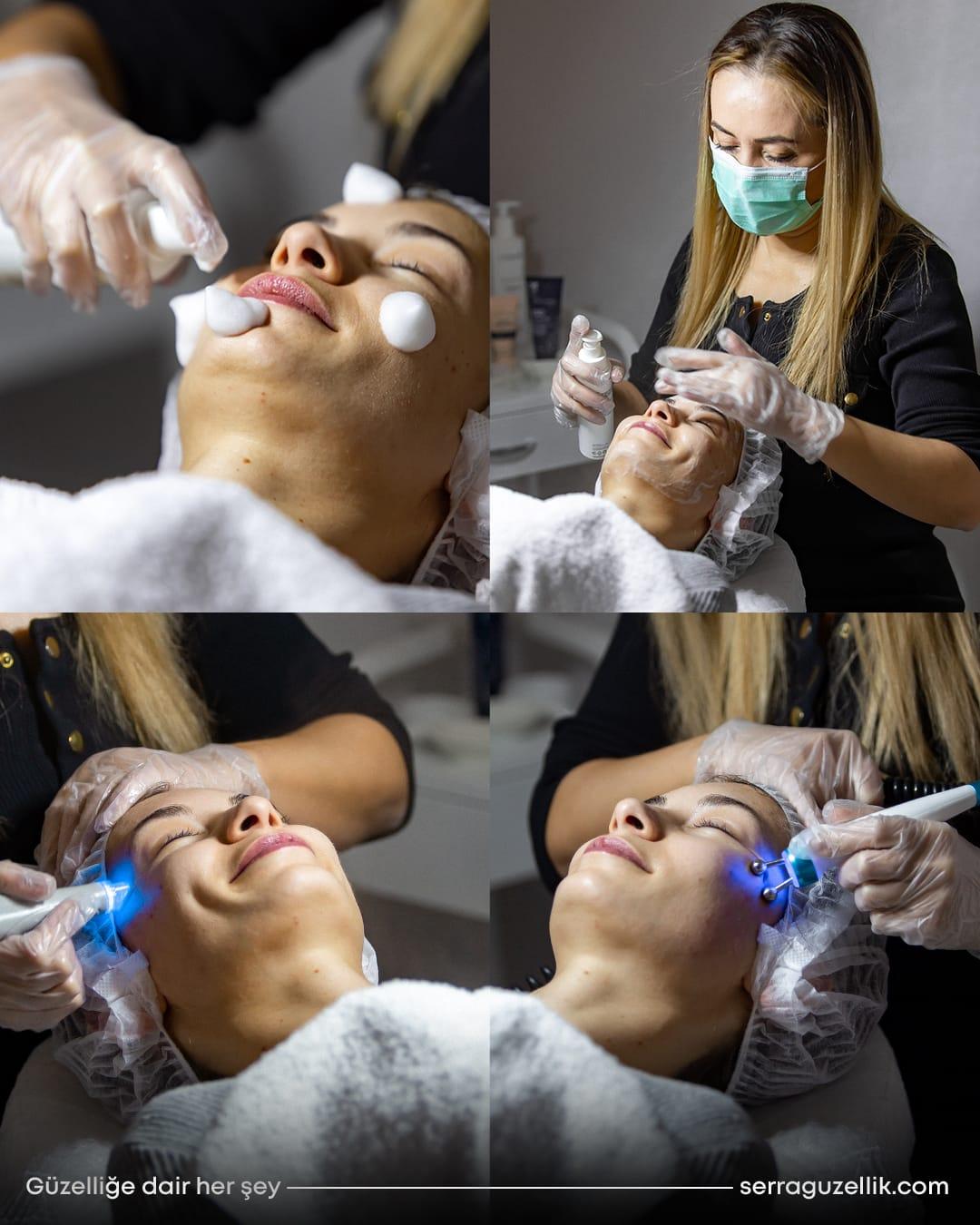 Serra Güzellik - Ümitköy  Cilt Yenileme - 3. Fotoğraf