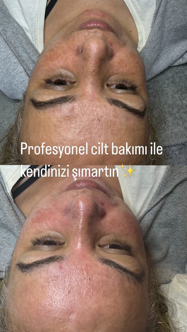 Plus Güzellik Merkezi - 11. Fotoğraf