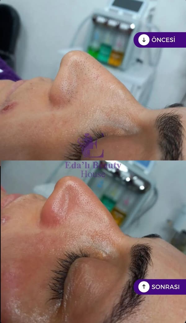 Edalı Beauty House - 10. Fotoğraf