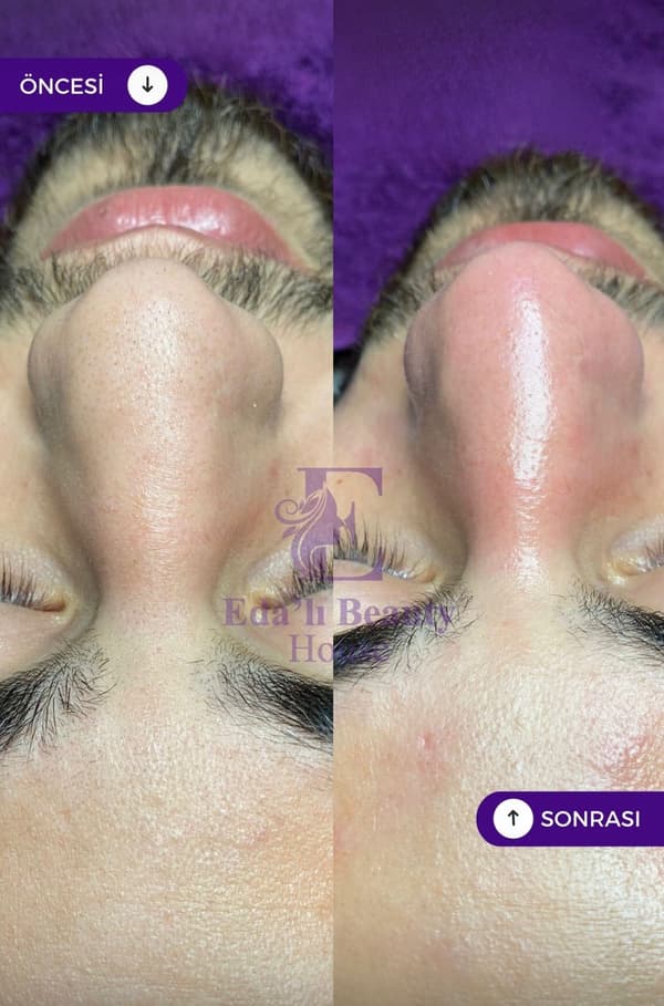 Edalı Beauty House - 3. Fotoğraf