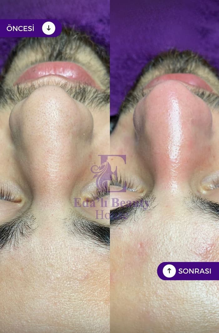 Edalı Beauty House - 3. Fotoğraf
