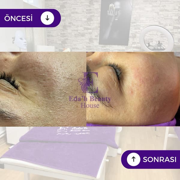 Edalı Beauty House - 4. Fotoğraf