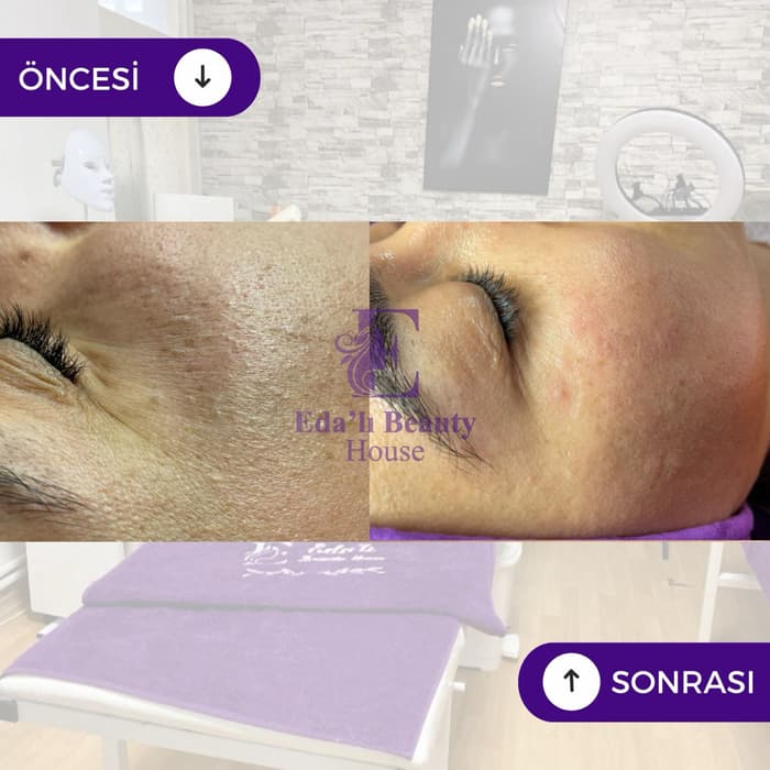 Edalı Beauty House - 4. Fotoğraf