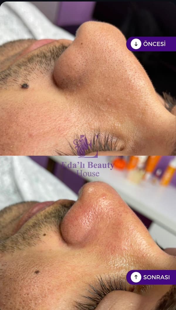 Edalı Beauty House - 9. Fotoğraf