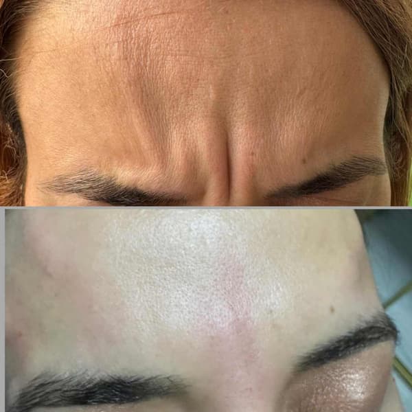 Tuğba Beauty Therapy - 25. Fotoğraf