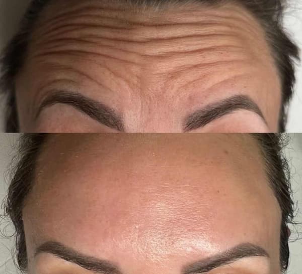 Tuğba Beauty Therapy - 12. Fotoğraf