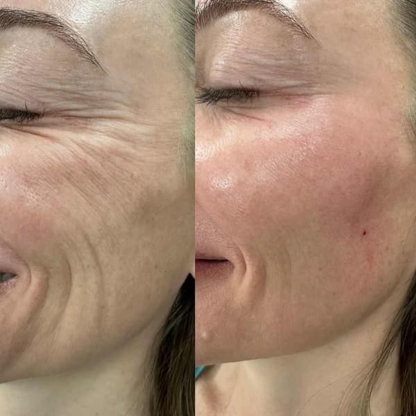 Tuğba Beauty Therapy - 7. Fotoğraf