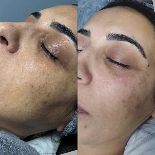 Tuğba Beauty Therapy - 15. Fotoğraf Tuğba Beauty Therapy - 15. Fotoğraf