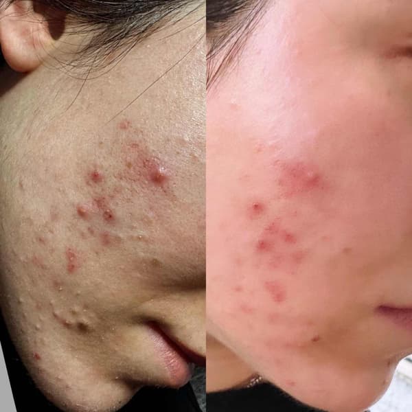 Tuğba Beauty Therapy - 29. Fotoğraf