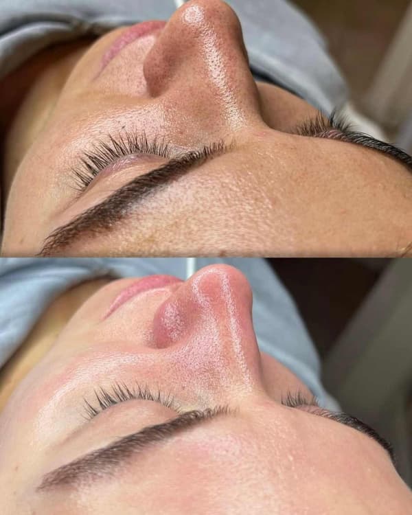 Tuğba Beauty Therapy - 4. Fotoğraf Tuğba Beauty Therapy - 4. Fotoğraf