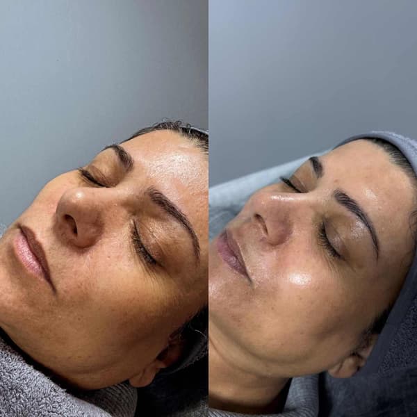 Tuğba Beauty Therapy - 18. Fotoğraf