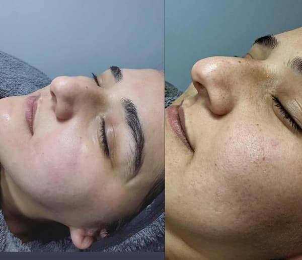 Tuğba Beauty Therapy - 13. Fotoğraf