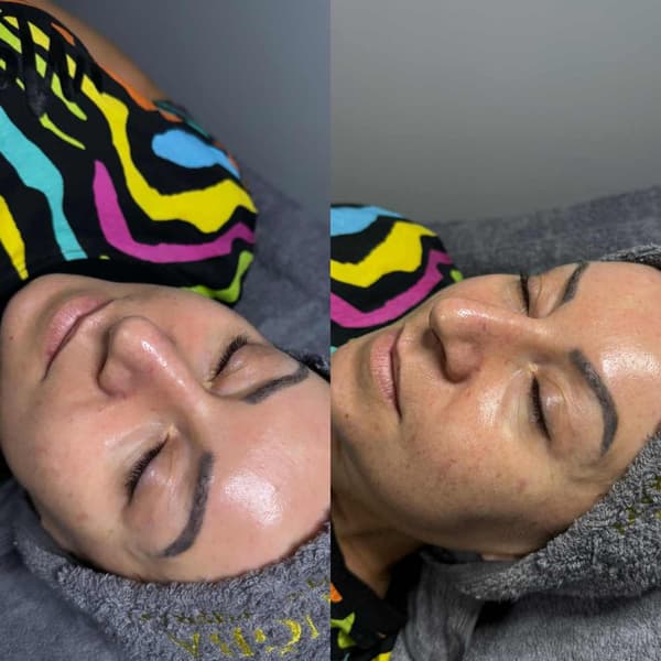 Tuğba Beauty Therapy - 23. Fotoğraf Tuğba Beauty Therapy - 23. Fotoğraf