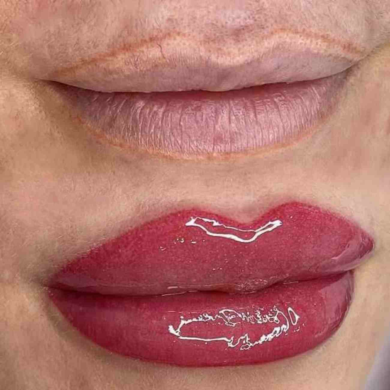 ND Beauty Center - Batıkent Cilt Yenileme - 4. Fotoğraf