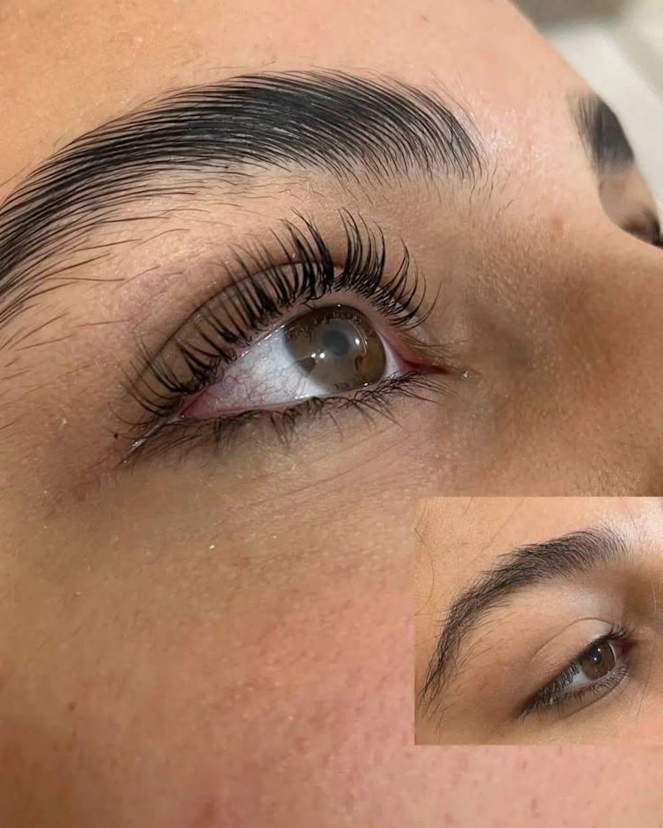 ND Beauty Center - Batıkent Cilt Yenileme - 3. Fotoğraf