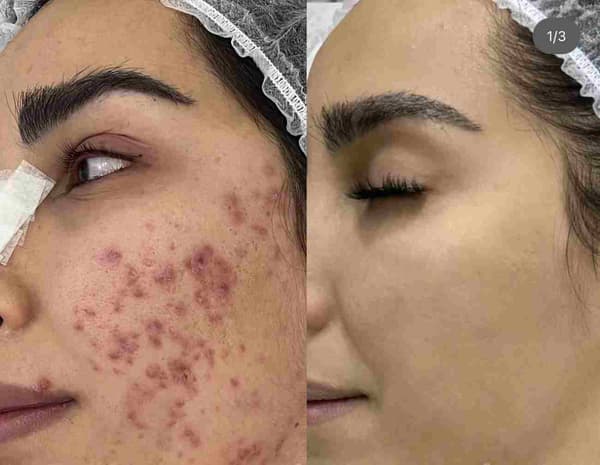 Buket Alakuş Beauty Club - 10. Fotoğraf