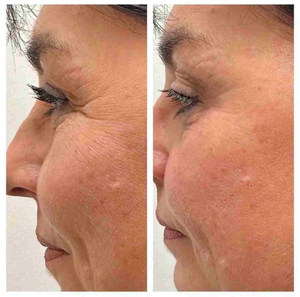 Buket Alakuş Beauty Club - 12. Fotoğraf