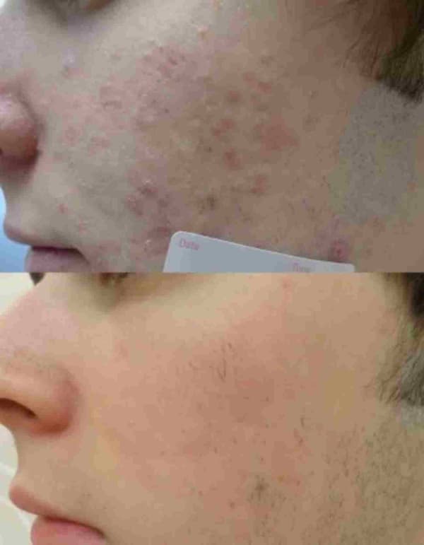 Buket Alakuş Beauty Club - 5. Fotoğraf