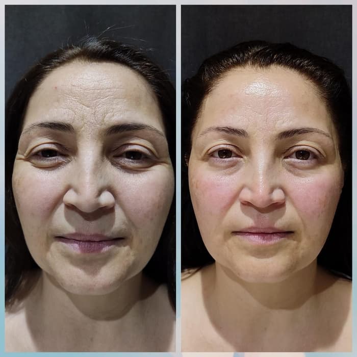 Merve Şensoy Güzellik Merkezi - 3. Fotoğraf
