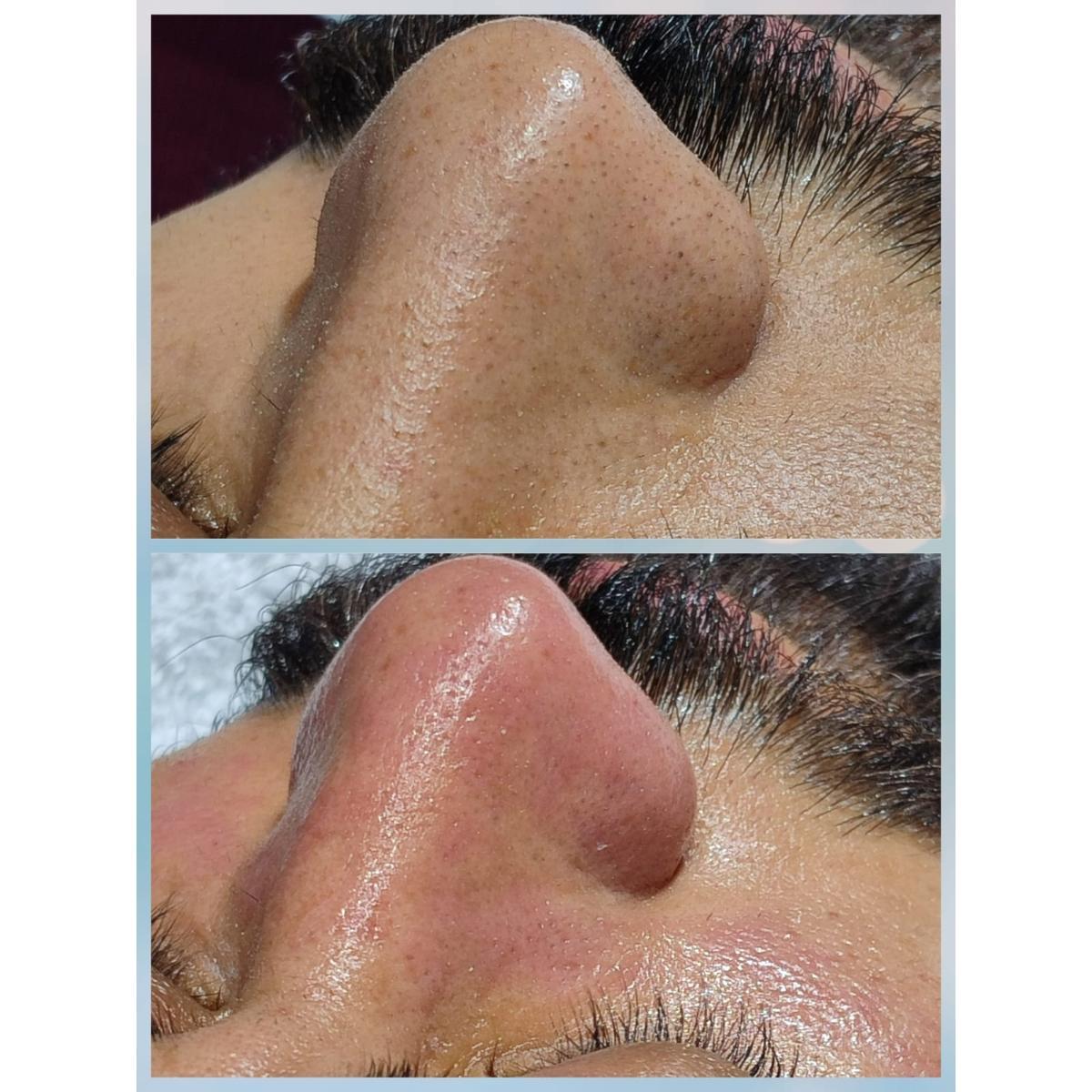 Merve Şensoy Güzellik Merkezi