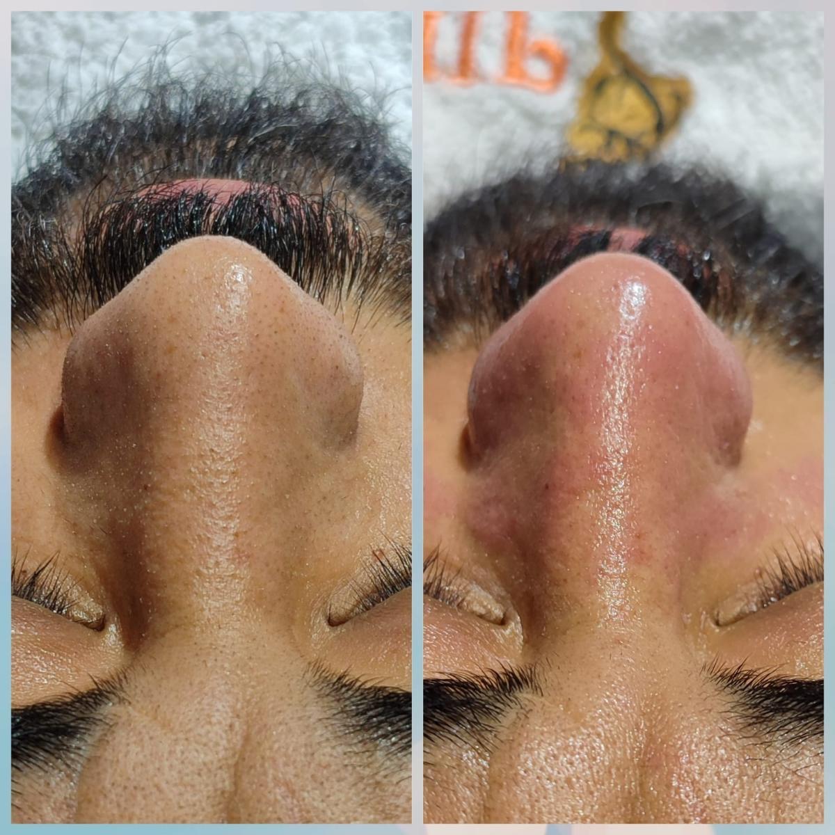 Merve Şensoy Güzellik Merkezi